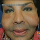 Image for article titled WebOS Stalling, More Cement Implants, and Other Stories We Didn't Post
